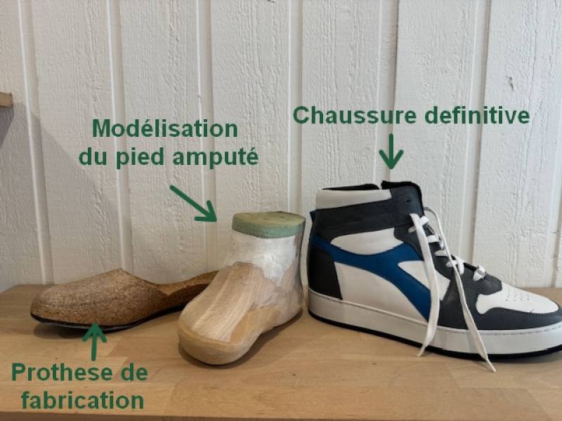 Comment choisir ses chaussures orthopédiques après une amputation du pied sur Bordeaux ?